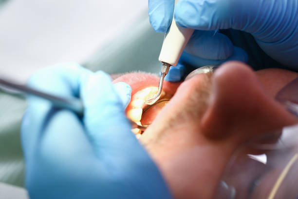 Best Emergency TMJ Treatment in La Joya, TX