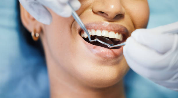 Best Emergency Denture Repair in La Joya, TX