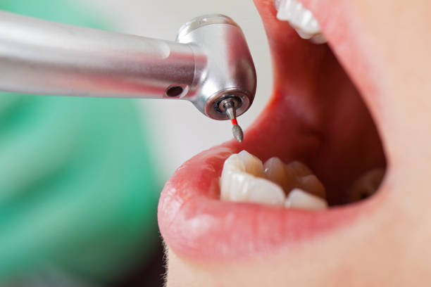 Best Emergency Denture Repair in La Joya, TX